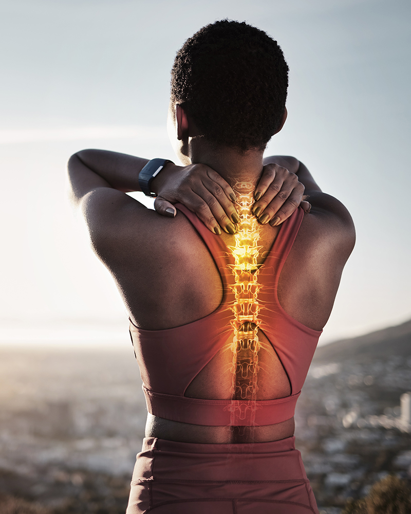 Kyphosis