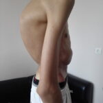 Scoliosis Treatment in Sonoma County with Dr. Dimitriy Kondrashov