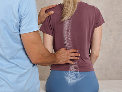 Spinal deformities include scoliosis, kyphosis and axial plane deformities. 